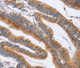 Anti-Human SIGLEC6 Antibody - ABMIUM