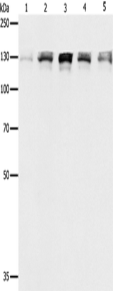 Anti-Human/Mouse/Rat DDB1 Antibody - ABMIUM