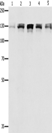 Anti-Human/Mouse/Rat DDB1 Antibody - ABMIUM