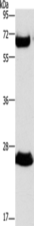 Anti-Human/Rat GGT1 Antibody - ABMIUM