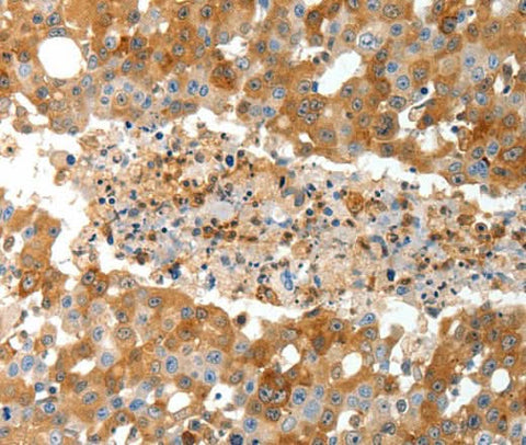 Anti-Human TEP1 Antibody - ABMIUM