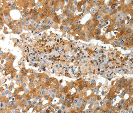 Anti-Human TEP1 Antibody - ABMIUM