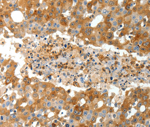 Anti-Human TEP1 Antibody - ABMIUM