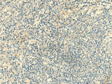 Immunohistochemistry of paraffin-embedded Human tonsil tissue using CLEC10A Polyclonal Antibody at dilution of 1:50(×200)