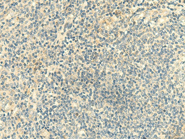 Immunohistochemistry of paraffin-embedded Human tonsil tissue using CLEC10A Polyclonal Antibody at dilution of 1:50(×200)