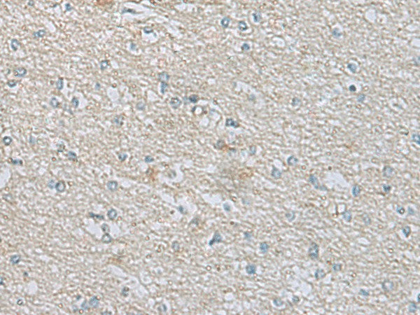 Immunohistochemistry of paraffin-embedded Human brain tissue using CDH12 Polyclonal Antibody at dilution of 1:60(×200)