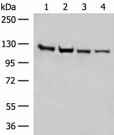 Western blot analysis of Human fetal brain tissue K562 cell Hela and A172 cell lysates using IPO11 Polyclonal Antibody at dilution of 1:450