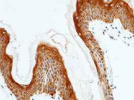 Anti-Human IL20RA Antibody [B254]