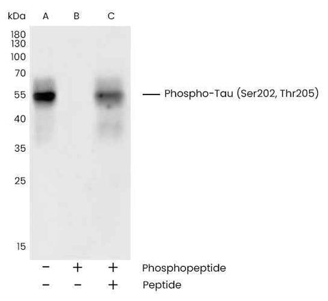 Anti-Human MAPT Antibody [B304] - ABMIUM