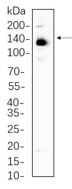 Anti-Human/Mouse/Rat ULK1 Antibody [B1083] - ABMIUM