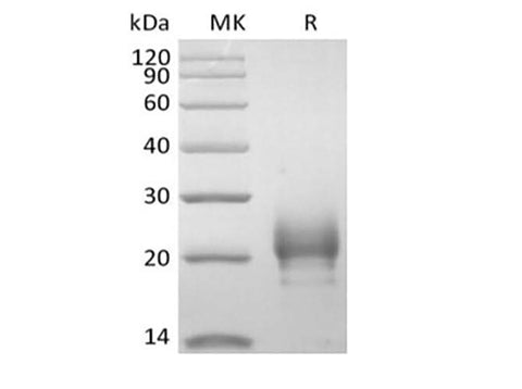 Recombinant Human Thymic Stromal Lymphopoietin/TSLP (R127A, R130A, C-10His) - ABMIUM