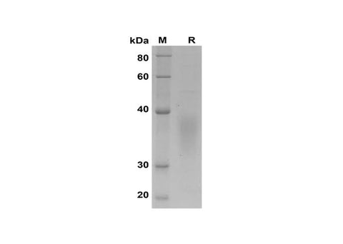 SDS-PAGE analysis of Human CD30L/TNFSF8 proteins, 2 μg/lane of Recombinant Human CD30L/TNFSF8 proteins was resolved with SDS-PAGE under reducing conditions, showing bands at 30-40 kDa.