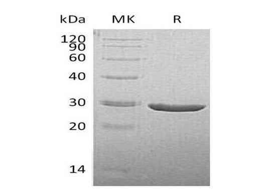 Recombinant Human TPK1 Protein (His Tag) - ABMIUM