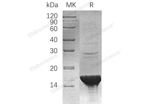 Recombinant Human UBE2B/HR6B Protein - ABMIUM