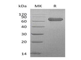 Recombinant Human LTBR/TNFRSF3 Protein (Fc Tag) - ABMIUM