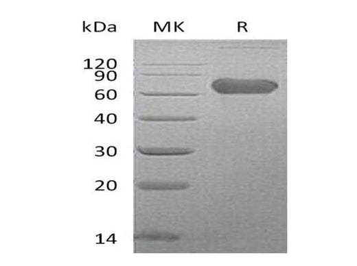 Recombinant Human LTBR/TNFRSF3 Protein (Fc Tag) - ABMIUM