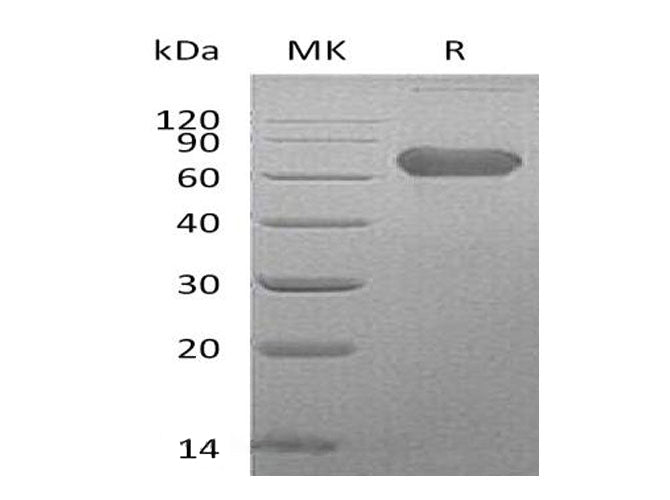 Recombinant Human LTBR/TNFRSF3 Protein (Fc Tag) - ABMIUM