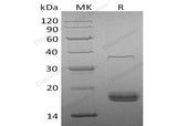Recombinant Human VEGF-D/VEGFD Protein (His Tag) - ABMIUM