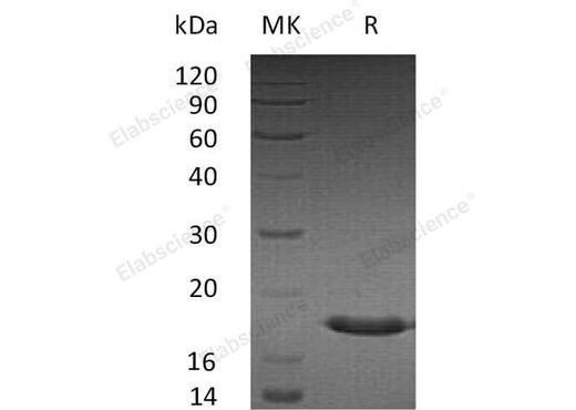 Recombinant Human SUMO3/SMT3A Protein - ABMIUM
