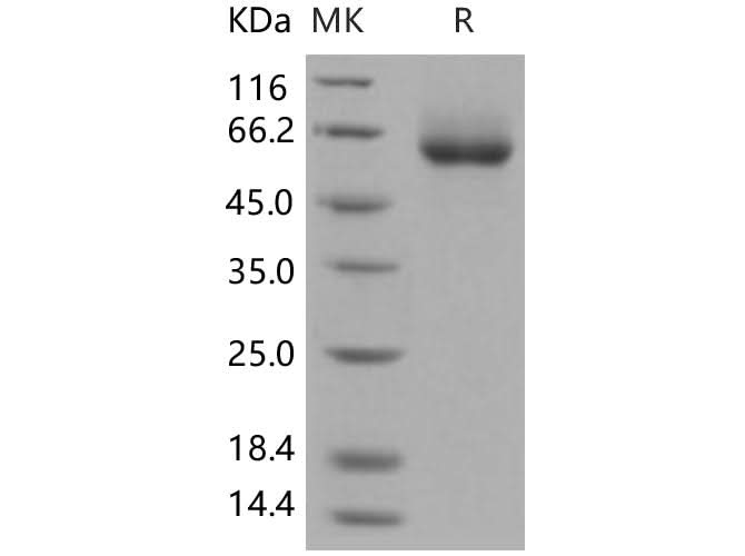 Recombinant Human ENPP7/NPP-7 Protein (His Tag) - ABMIUM