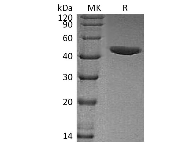 Recombinant Human CHI3L1/YKL40 Protein (His Tag) - ABMIUM