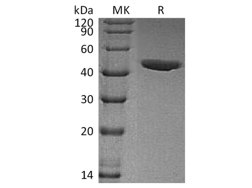 Recombinant Human CHI3L1/YKL40 Protein (His Tag) - ABMIUM