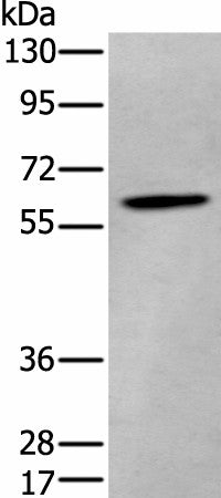 Western blot analysis of Human cerebrum tissue lysate using ZKSCAN1 Polyclonal Antibody at dilution of 1:400