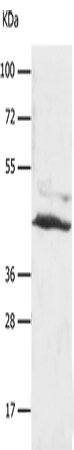 Anti-Human SLC16A7 Antibody - ABMIUM