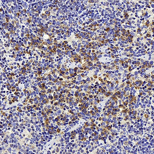 Immunohistochemistry analysis of paraffin-embedded mouse spleen using ATG7 Polyclonal Antibody at dilution of 1:300.