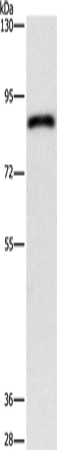 Anti-Human/Mouse/Rat APEH Antibody - ABMIUM