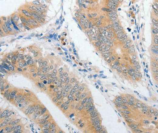 Anti-Human PIBF1 Antibody