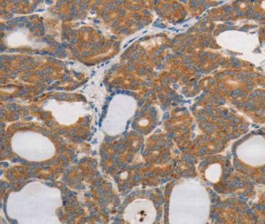 Anti-Human/Mouse/Rat PPP2CB Antibody