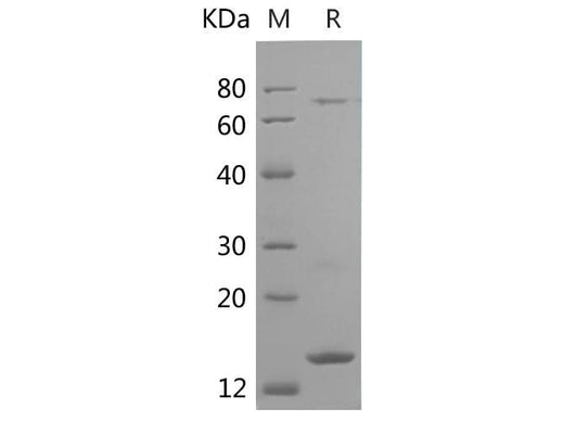 SDS-PAGE analysis of Human Ub proteins, 2 μg/lane of Recombinant Human Ub proteins was resolved with SDS-PAGE under reducing conditions, showing bands at 15 kDa.