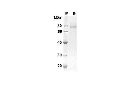 SDS-PAGE analysis of Mouse Cd36 proteins, 2 μg/lane of Recombinant Mouse Cd36 proteins was resolved with an SDS-PAGE under reducing conditions, showing bands at 44.9 kDa.