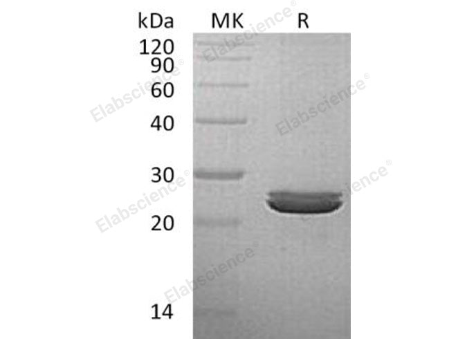 Recombinant Human LYG2 Protein (His Tag) - ABMIUM