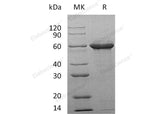 Recombinant Human Tau-F Protein - ABMIUM