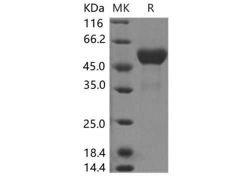 Recombinant Human TL1A Protein (Fc Tag) - ABMIUM