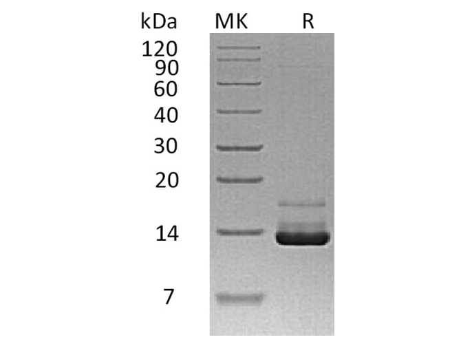 Recombinant Human Parathyroid Hormone/PTH Protein (His Tag) - ABMIUM