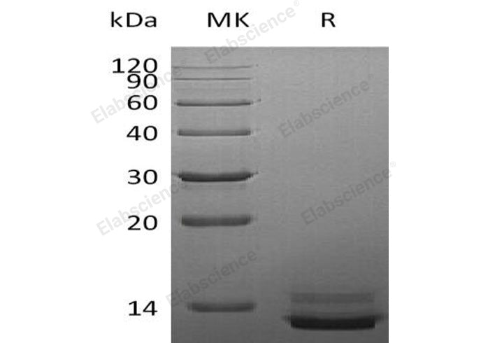Recombinant Human PPY Protein (His Tag) - ABMIUM