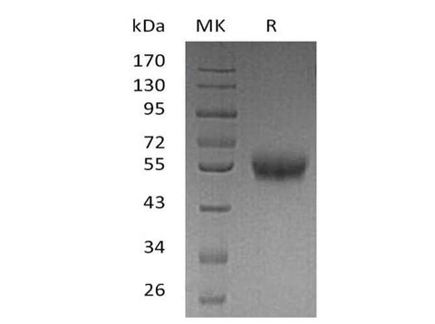 Recombinant Human 4-1BB/TNFRSF9 Protein (Fc & His Tag) - ABMIUM