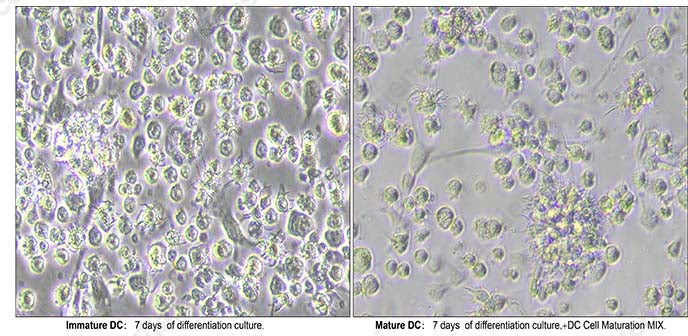 Morphological observation of BMDC: immature DC (left) cells have a few dendritic projections and few cells aggregate and grow in clusters; mature DC cells (right) have more dendritic projections and more cell clusters.