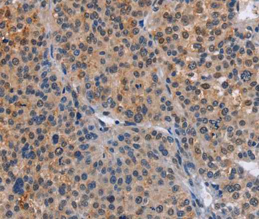 Anti-Human/Mouse MAP3K13 Antibody