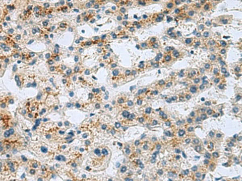 Anti-Human GHRHR Antibody - ABMIUM