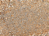 Immunohistochemistry of paraffin-embedded Human tonsil tissue using GNGT2 Polyclonal Antibody at dilution of 1:40(×200)