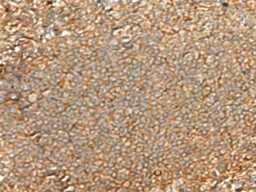 Anti-Human/Mouse GNGT2 Antibody