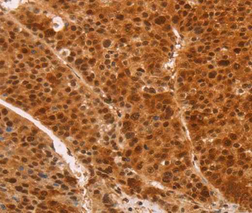 Anti-Human/Mouse/Rat HEXIM1 Antibody