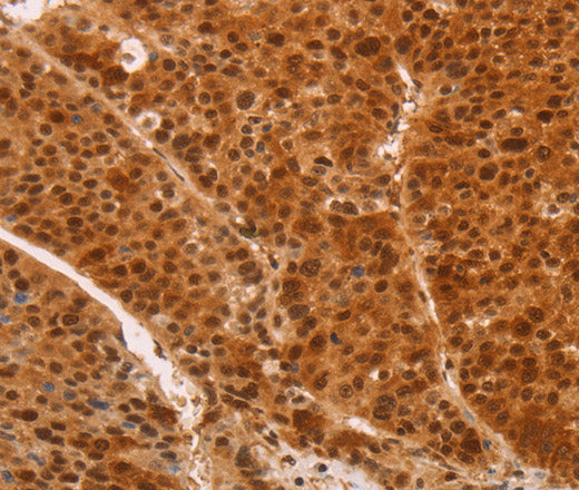 Anti-Human/Mouse/Rat HEXIM1 Antibody - ABMIUM