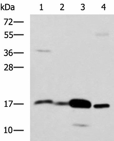 Western blot analysis of Mouse Pancreas tissue Mouse small intestines tissue Mouse large intestine tissue Human sigmoid tissue lysates using ZG16 Polyclonal Antibody at dilution of 1:1350