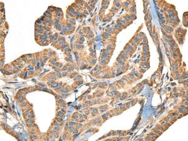 Anti-Human SLAMF7 Antibody