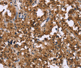 Anti-Human GPR171 Antibody - ABMIUM